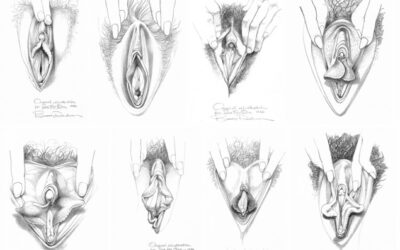 Variation in Vulvas