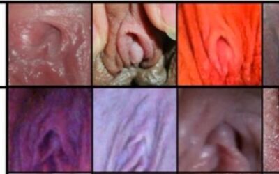 The Variation of Clitoral Hoods